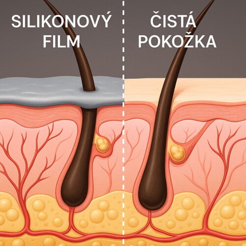 Silikony a nánosy na pokožce hlavy mohou bránit tvorbě pigmentu a přispívat k šedivění.