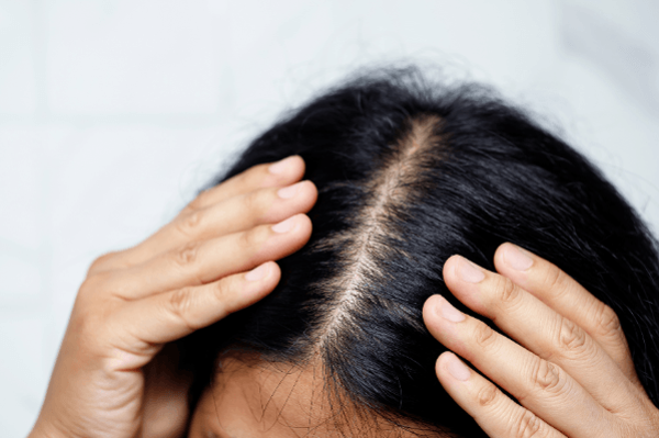 Hair skin analysis Discover your type of hair skin