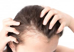 Bojujete s vážným vypadáváním vlasů? K tomu, abyste to ZASTAVILI, potřebujete pouze těchto 7 tipů..