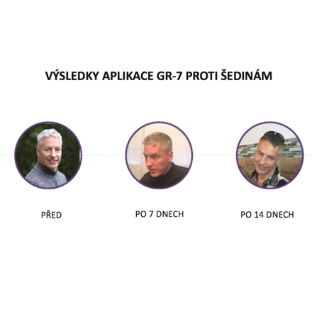 Před a po aplikaci GR-7 tonika na šedivé vlasy