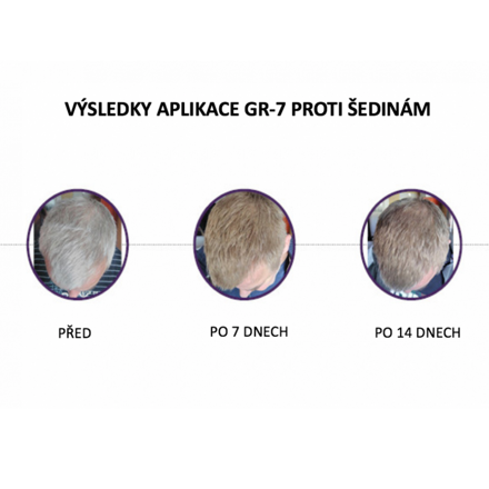 Před a po aplikaci GR-7 tonika na šedé vlasy