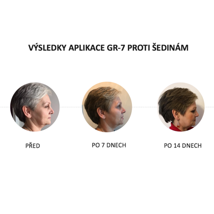 Před a po aplikaci GR-7 tonika na šedé vlasy