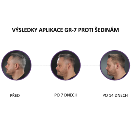 Před a po aplikaci GR-7 tonika na šedivé vlasy