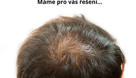Řídnoucí vlasy u mužů: Způsoby, jak přidat objem a posílit vlasy